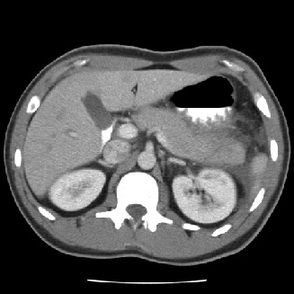 Pancreas